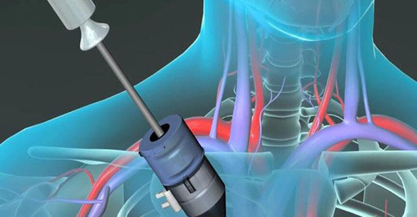 �Ϸ����S�Ӯ�����